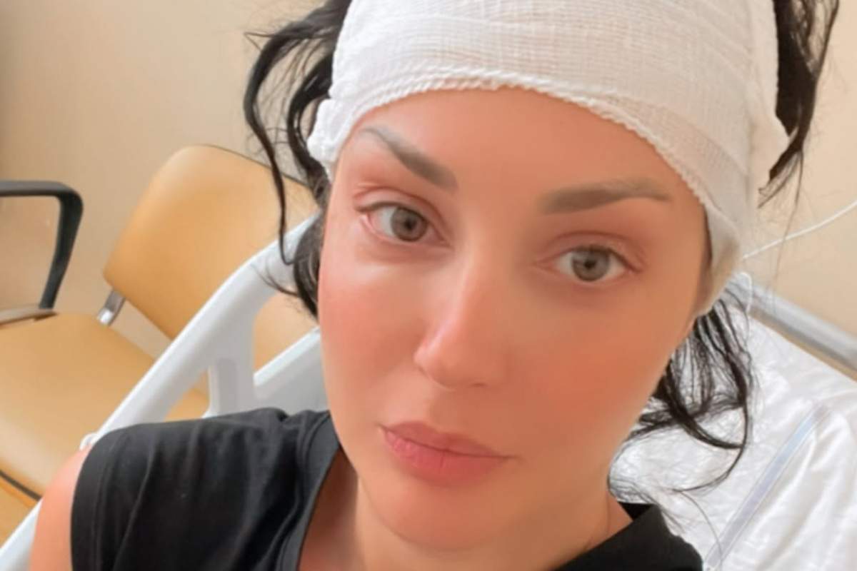 Diletta Pagliano con benda sulla testa