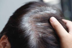 mano su capelli grigi